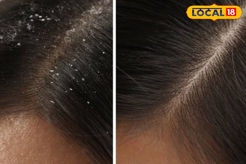 अमलतास की फली 