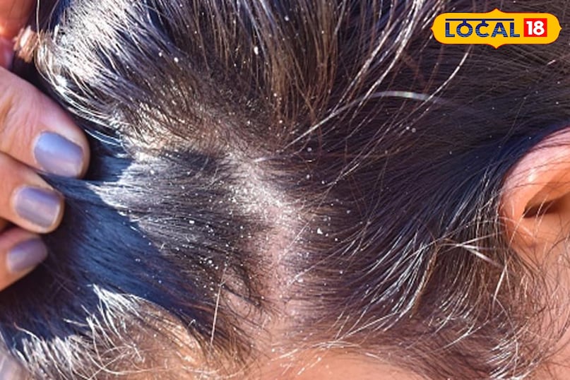 अमलतास की फली 