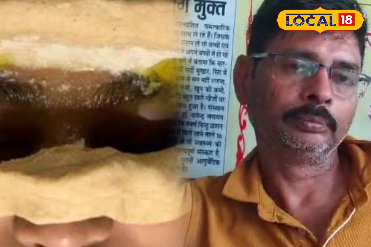 आयुर्वेद का चमत्कार! बिना ऑपरेशन ठीक हुआ मोतियाबिंद, क्या है अक्षितर्पण?