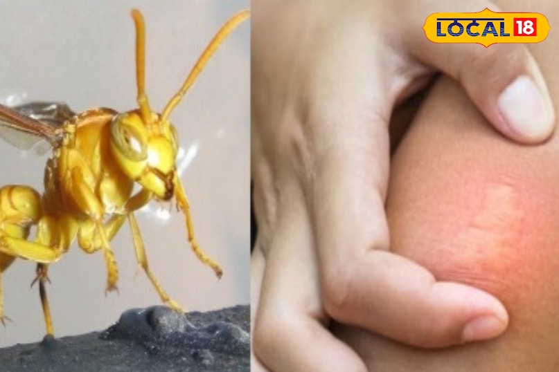 ततैया के काटने से सिर्फ दर्द होता है, जिसे घरेलू इलाज से ही ठीक हो सकती है लेकिन कई बार मामले गंभीर हो जाते हैं. ऐसे में कभी एलर्जी की समस्या हो सकती है. ऐसे में कभी लापरवाही नहीं करना चाहिए. इसलिए ततैया के काटने पर तुरंत बेहतर इलाज करना चाहिए. ऐसे में इसके काटने से होने वाले दुष्प्रभाव से बचा जा सके. ततैया के काटने से सिर्फ दर्द होता है, जिसे घरेलू इलाज से ही ठीक हो सकती है लेकिन कई बार मामले गंभीर हो जाते हैं. ऐसे में कभी एलर्जी की समस्या हो सकती है. ऐसे में कभी लापरवाही नहीं करना चाहिए. इसलिए ततैया के काटने पर तुरंत बेहतर इलाज करना चाहिए. ऐसे में इसके काटने से होने वाले दुष्प्रभाव से बचा जा सके.