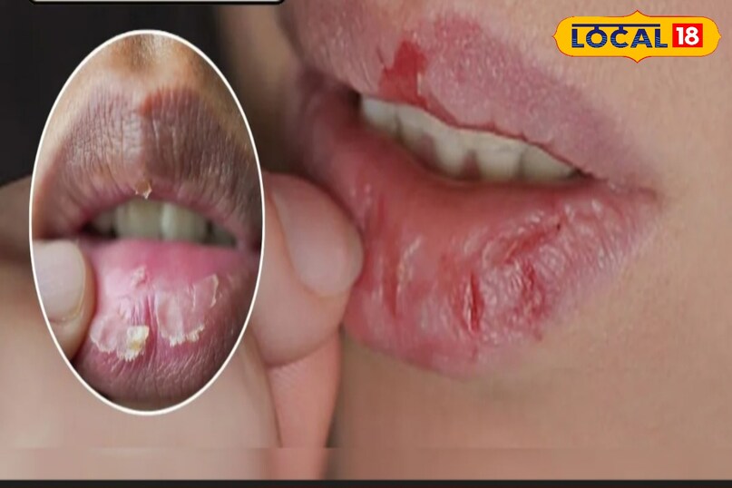 घरेलू उपाय है कारगर 