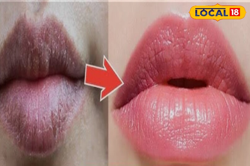 आजमाए हुए है ये नुस्खे 