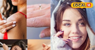 ब्यूटी टिप्स 