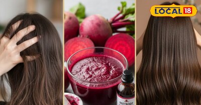 बालों के लिए अमृत 