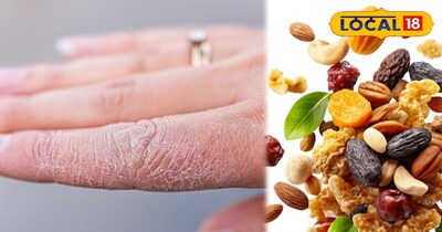 Troubled by dry skin and dandruff this winter? Try these 6 easy and effective re