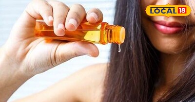 सर्दियों में बढ़ते हेयर फॉल को सही देखभाल से करें कंट्रोल