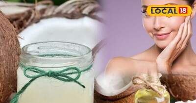 रूखी त्वचा के लिए नारियल तेल और एलोवेरा जेल का देसी फॉर्मूला, ऐसे लौटाएँ चेहरे की नमी