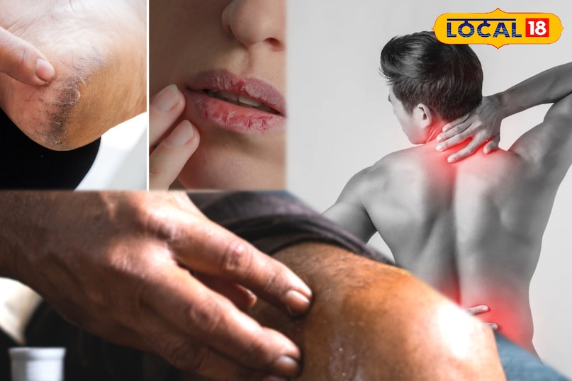 सिर्फ 2 बूंद तेल, नाभि में तेल डालने से त्वचा को मिलती है नमी... सिर्फ 2 बूंद तेल, नाभि में तेल डालने से त्वचा को मिलती है नमी...