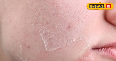 सर्दियों में स्किन का ख्याल 