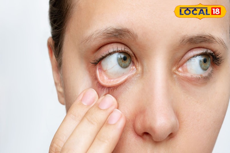 Try home remedies with the advice of a doctor Try home remedies with the advice of a doctor