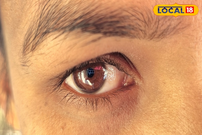 Why is coconut oil beneficial? 