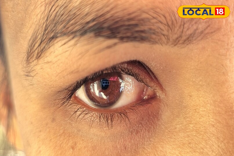 Other winter eye care tips