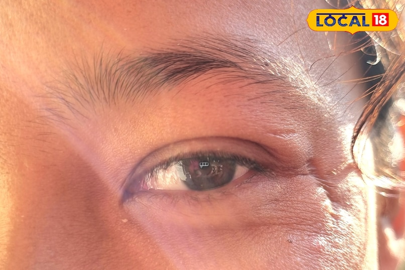 It is important to know the correct method of application 