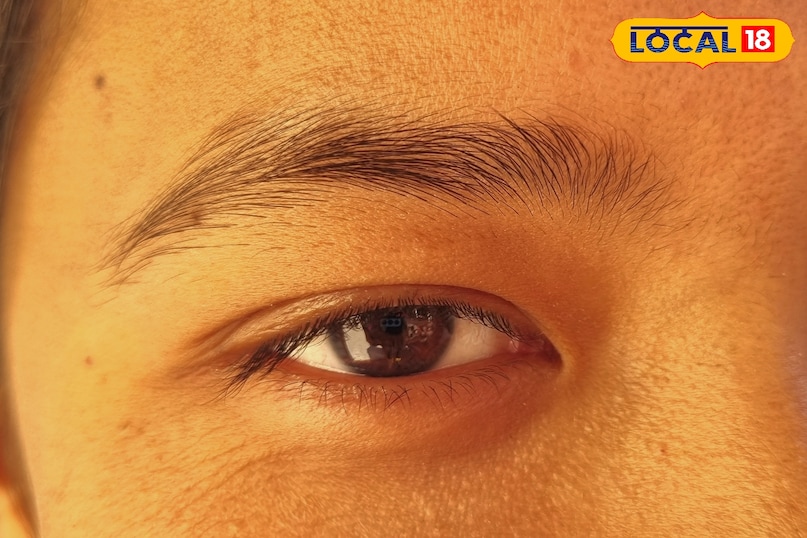 How to get relief from itching and burning 