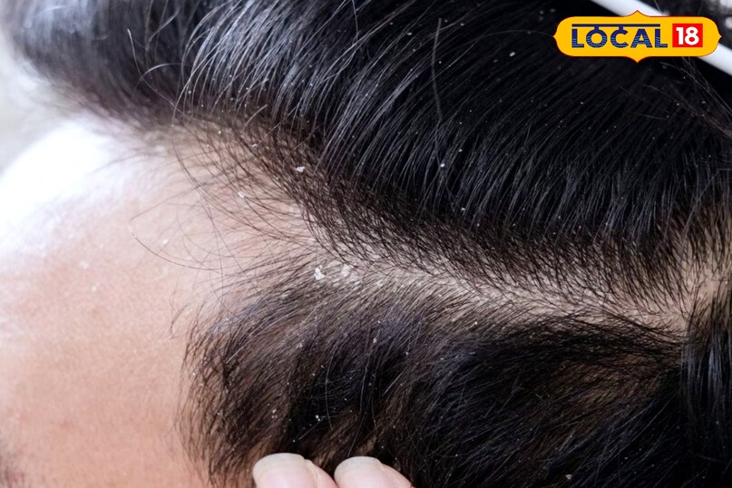 dendrof cleaning tips