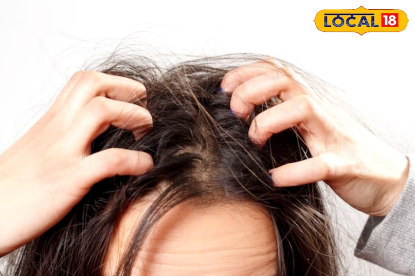 बालों का झड़ना रोके बालों का झड़ना रोके