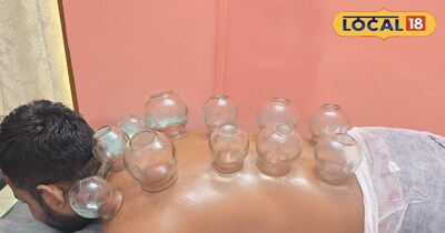 पैर, घुटने और कमर दर्द से राहत का भरोसेमंद समाधान फिजियोथेरेपी और फायर कपिंग हिज