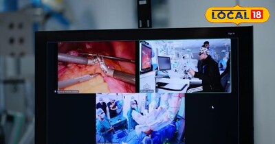 स्वदेशी सर्जिकल रोबोटिक सिस्टम SSII मंत्रा की सफल रोबोटिक टेलीसर्जरी