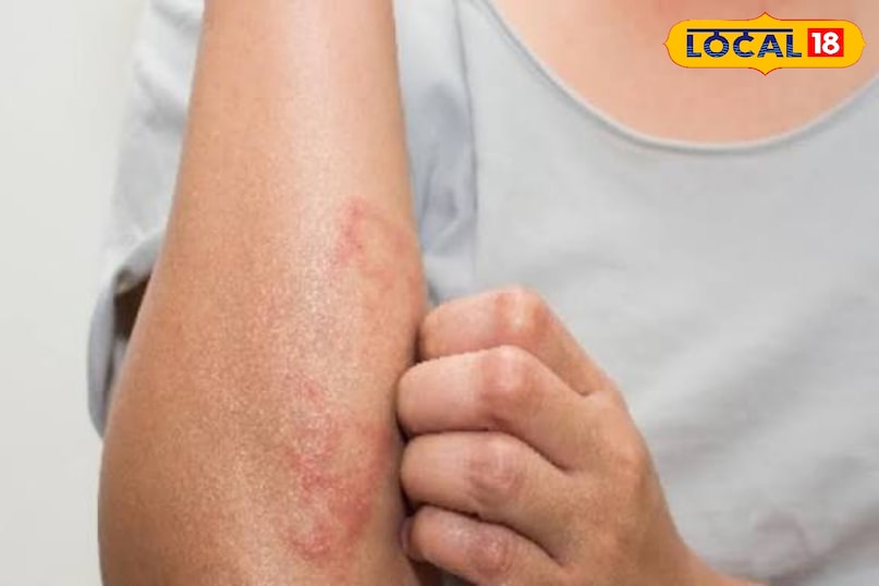 त्वचा रोग