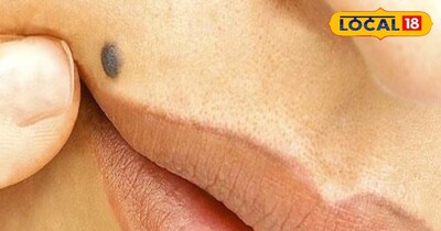 दाहिने तरफ तिल होता है शुभ