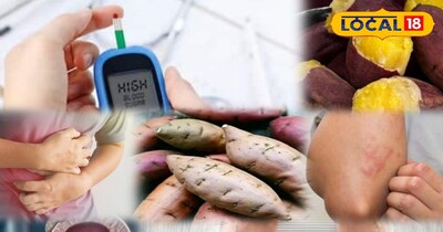 शकरकंद खाते हैं रोज़? तो जान लें इसके 3 गंभीर साइड इफेक्ट...