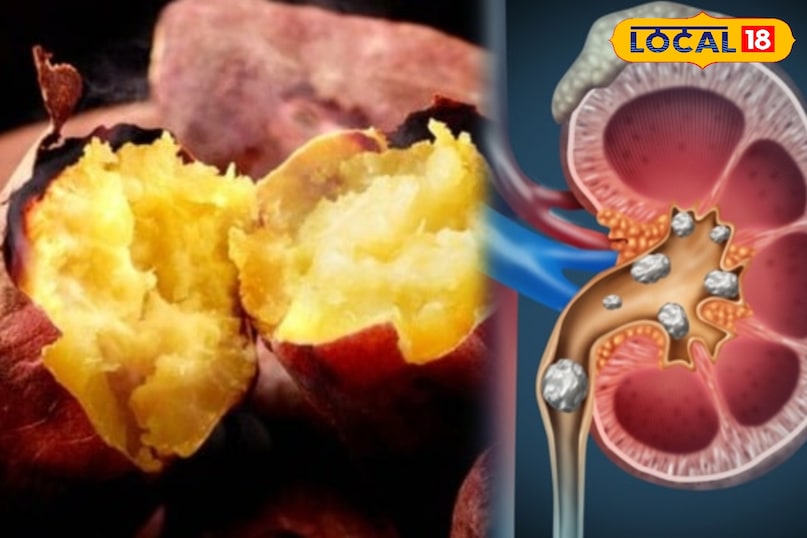 डायबिटीज और किडनी स्टोन वालों के लिए अलर्ट: शकरकंद के 3 नुकसान... डायबिटीज और किडनी स्टोन वालों के लिए अलर्ट: शकरकंद के 3 नुकसान...