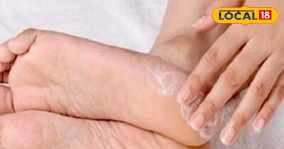 प्रतीकात्मक