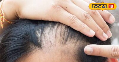 हेयर केयर