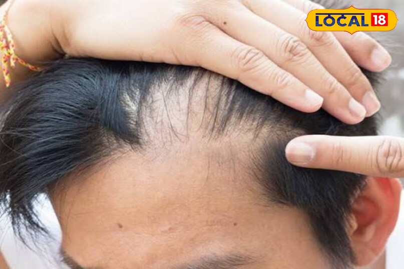 हेयर केयर