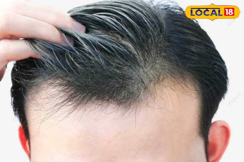 हेयर केयर