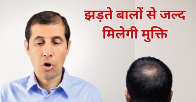 झड़ते बालों के लिए दवा. 