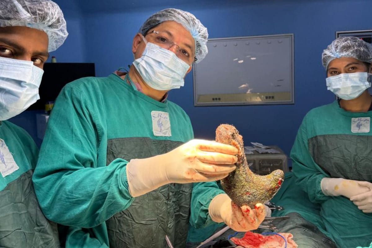 दुनिया में गिने-चुने केस, पेट खोलते ही डॉक्टर भी दंग, अंदर थी ऐसी चीज कि...