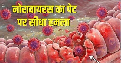 नोरावायरस आंत के माइक्रोबायोम को खराब कर देता है. (सांकेतिक तस्वीर)