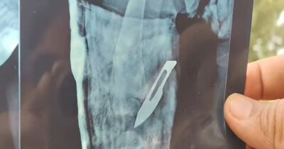 राजस्थान में चिकित्सा क्षेत्र में लापरवाही के मामले आए दिन सामने आते रहते हैं