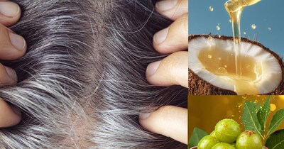 सफेद बालों के लिए बेस्ट ऑयल.