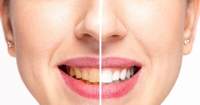 दातुन से दांतों के साथ पाचन और आंखों की सेहत में भी सुधार आता है.