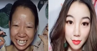 नकली पैर से लेकर आंखें तक, चीनी औरतें ऐसे देती हैं धोखा (इमेज- फाइल फोटो)