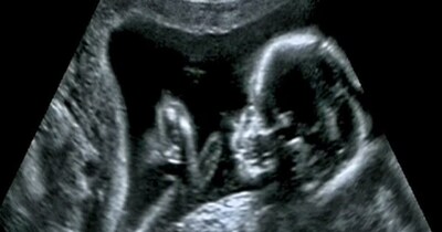 सरकार की तरफ से चैरिटी को मिल चुकी है वॉर्निंग (इमेज- फाइल फोटो) 