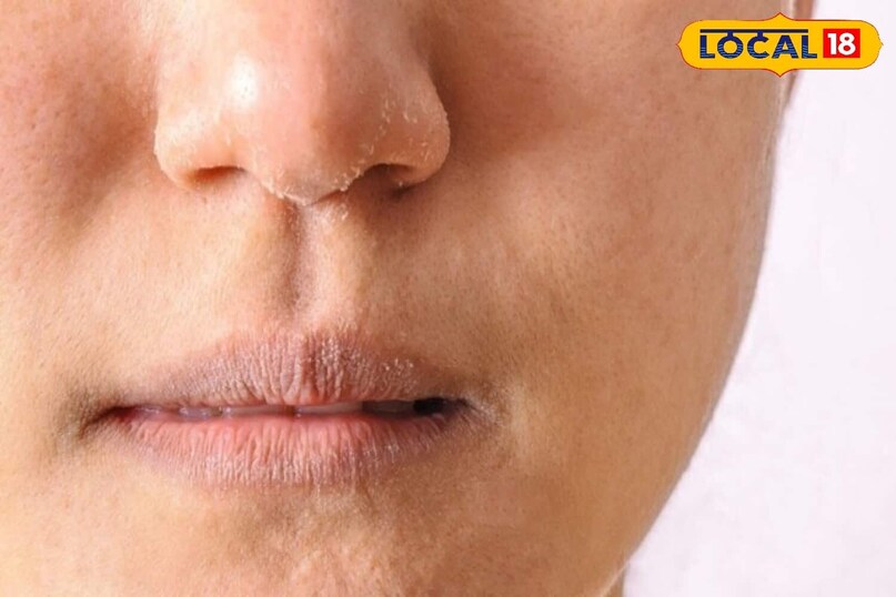 सर्दियों के मौसम में चेहरा दिखने लगा है रुखा, सफ़ेद पन तो घरेलू नुक्से से करें बचाव 