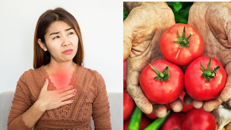 side effects of eating too many tomatoes kidney stones acidity and joint pain alert