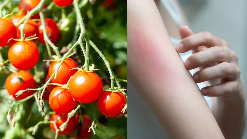 side effects of eating too many tomatoes kidney stones acidity and joint pain alert