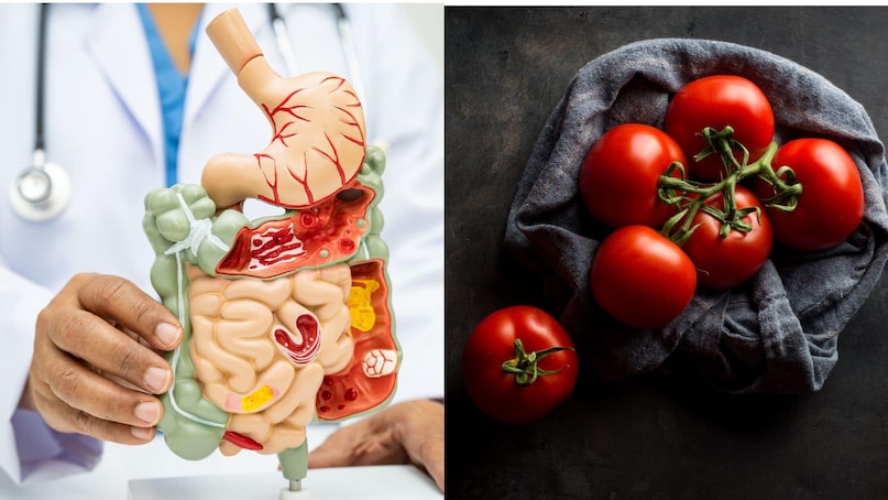 side effects of eating too many tomatoes kidney stones acidity and joint pain alert