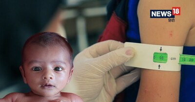 Gujarat's Malnutrition Crisis: 3.2 Million Children Malnourished Despite "Free" Claims