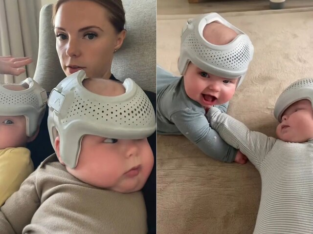 बच्चों के सिर का आकार ठीक करने का खोजा अजीब तरीका, मां पहनाती है हेलमेट!