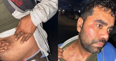 पटना ट्रैफिक पुलिस ने NMCH डॉक्टर-ड्राइवर की पिटाई, उठे सवाल