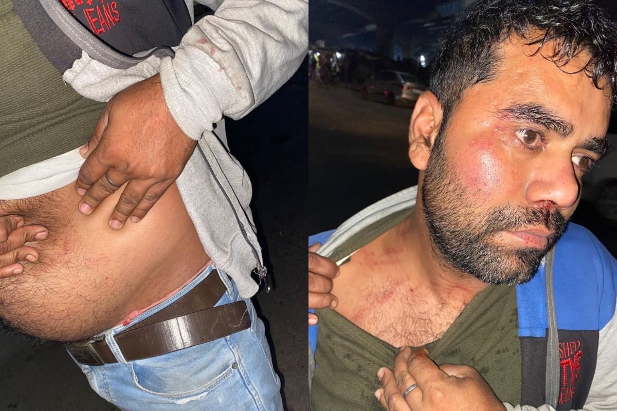 पटना में ‘खाकी की गुंडागर्दी’ दारोगा ने NMCH डॉक्टर और ड्राइवर से मारपीट की