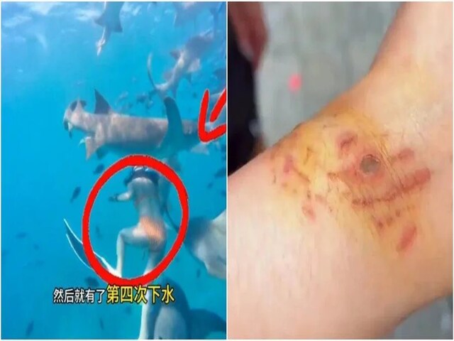 पीरियड्स में गई तैराकी करने, खून सूंघते आ पहुंचे शार्क, काट-काटकर किया ऐसा हाल