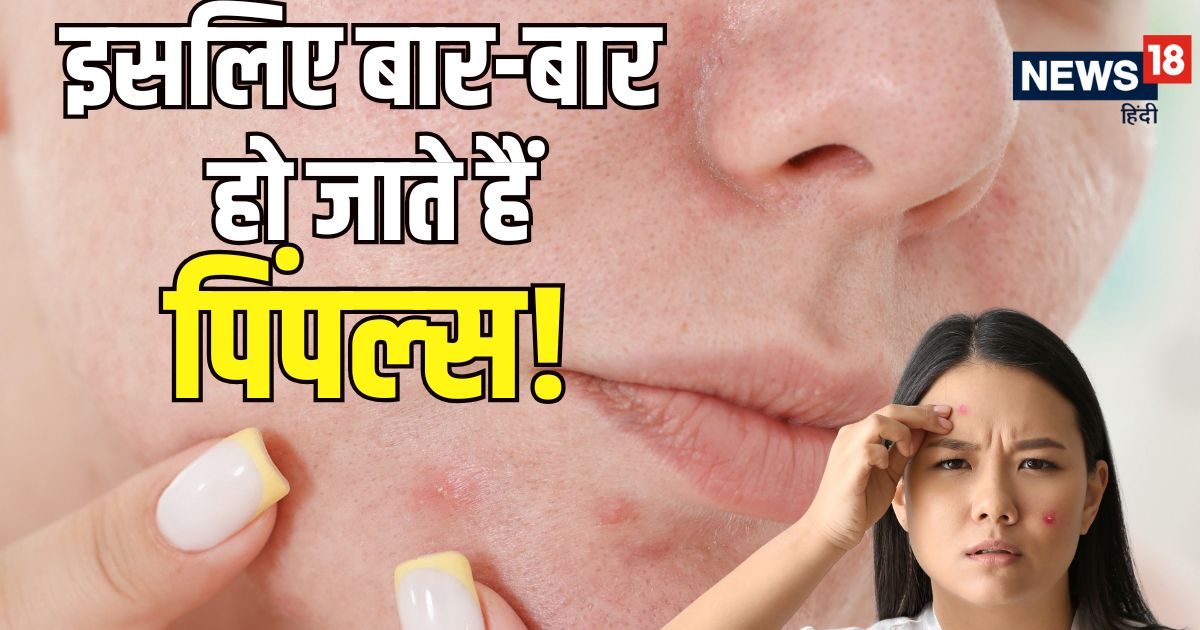 Beautiful view of Cheek Acne Treatment Tips