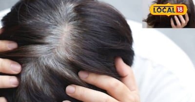 लेकिन चिंता करने की जरूरत नहीं है. घर पर कुछ आसान और प्राकृतिक उपाय अपनाकर बालों का समय से पहले सफेद होना रोका जा सकता है. दरभंगा के बाल विशेषज्ञों के अनुसार, सरसों के तेल और कुछ घरेलू सामग्री से बालों की जड़ें मजबूत होती हैं और सफेदी की समस्या कम होती है.