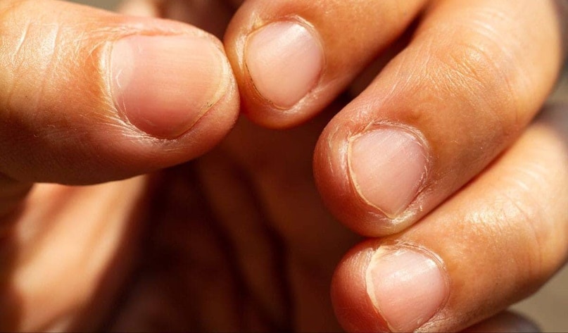 মানুষের আয়ু কতদিন, এই প্রশ্ন মানবসভ্যতার চিরন্তন কৌতূহল। নশ্বর জীবনে কে না জানতে চান, তিনি কতদিন বাঁচবেন? সম্প্রতি এই কৌতূহলকে নতুন মাত্রা দিয়েছে এক গবেষণা। সাম্প্রতিক গবেষণা অনুযায়ী, নখ থেকেই বোঝা যাবে আয়ুকালের রহস্য৷ 